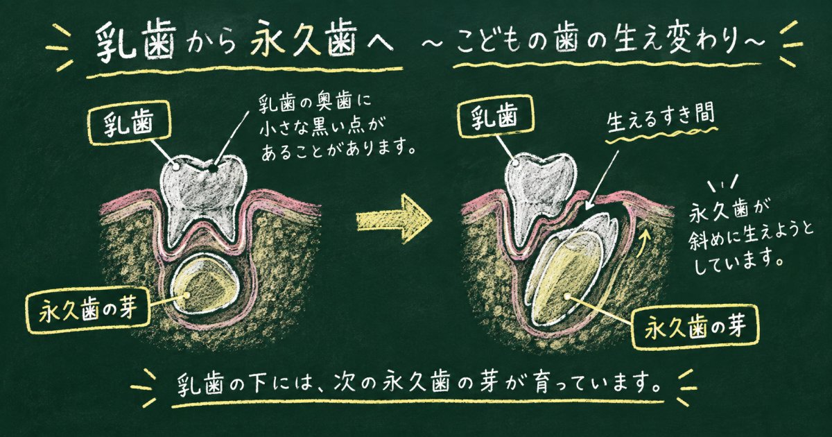 「様子見」で本当にいい?乳歯のむし歯と永久歯の歯並びの関係