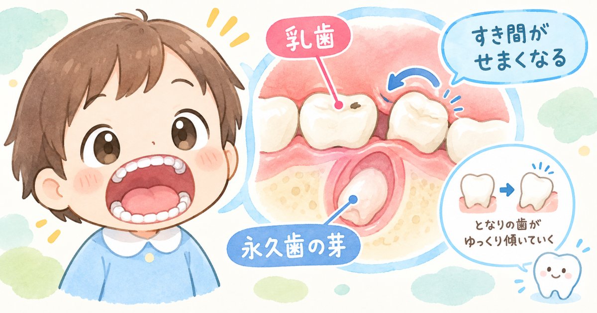 「様子見」の判断が招くリスク～乳歯むし歯と永久歯の歯並びが関係する仕組み
