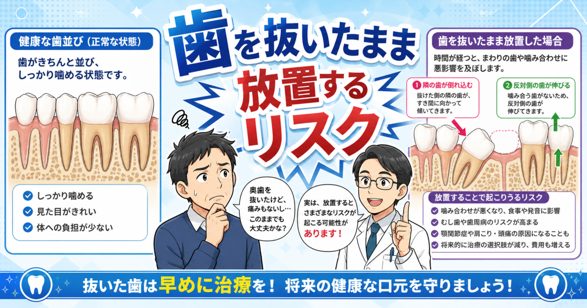 歯を抜いたまま放置するリスクとは？隣の歯が倒れる前にすべき事