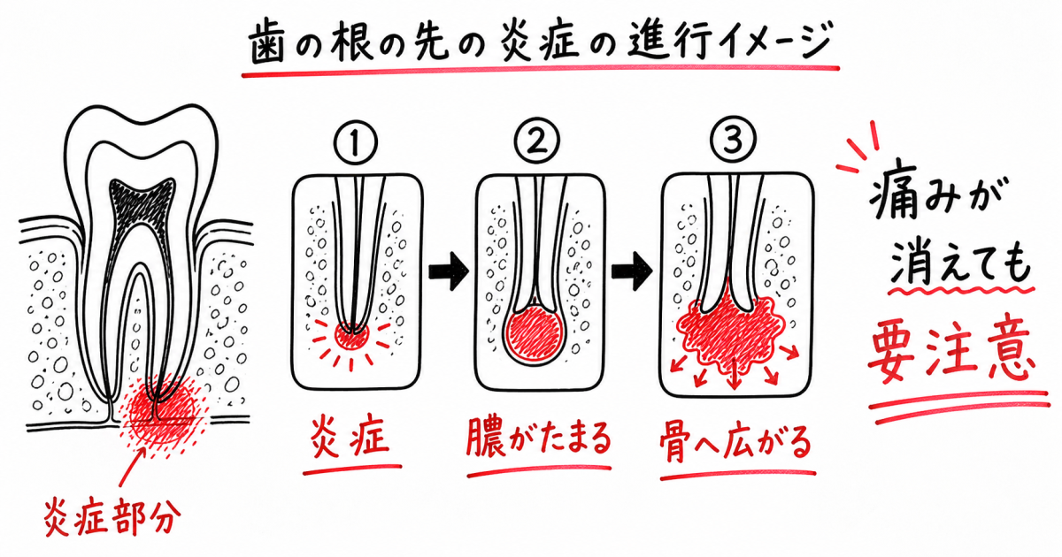 歯の根元がズキズキ痛む原因と放置する深刻なリスク