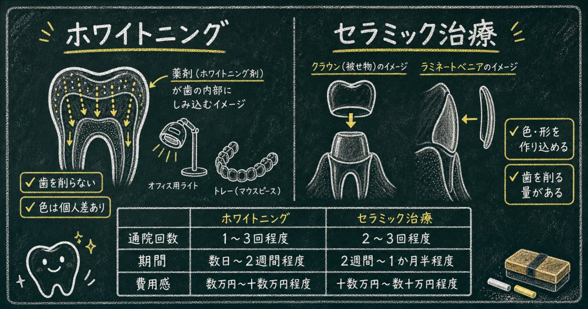 ホワイトニングとセラミックそれぞれの特徴と治療の目安