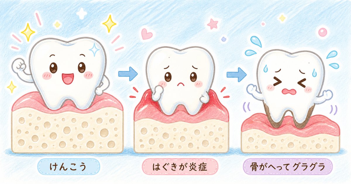 歯周病を放置すると歯が抜ける？進行段階と骨が溶けるメカニズム