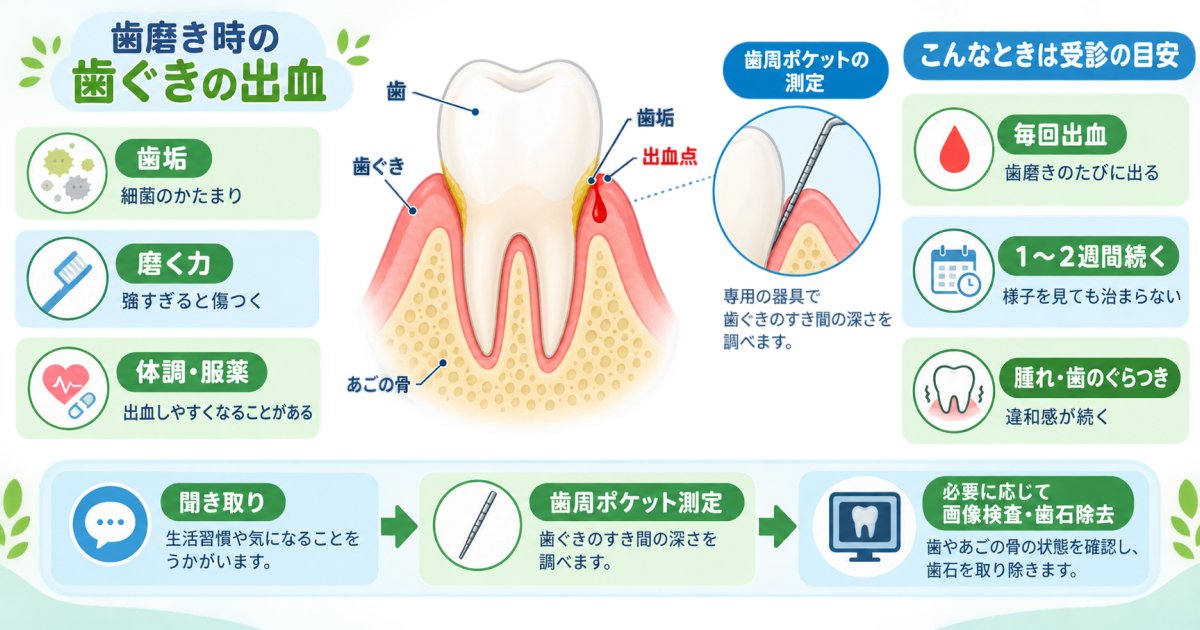 歯磨きのたびに歯茎から血が出て心配…歯周病の兆候と受診目安