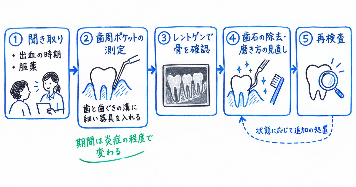 歯科では何を調べ、歯周病ならどう治療する?